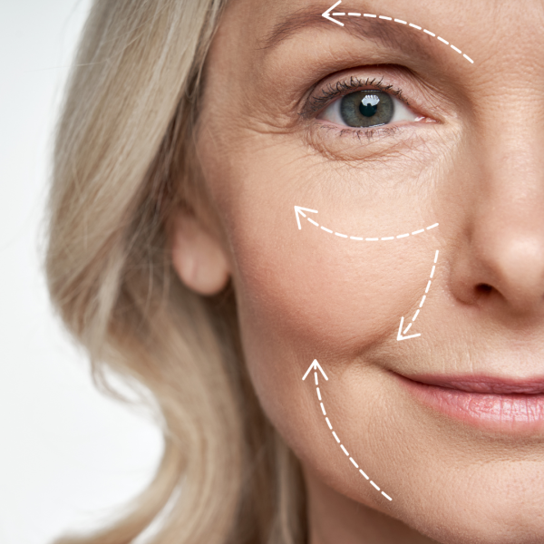 PRP Facial